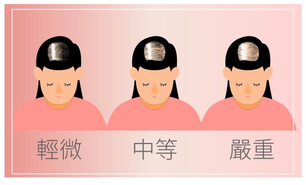 瀰漫性掉髮